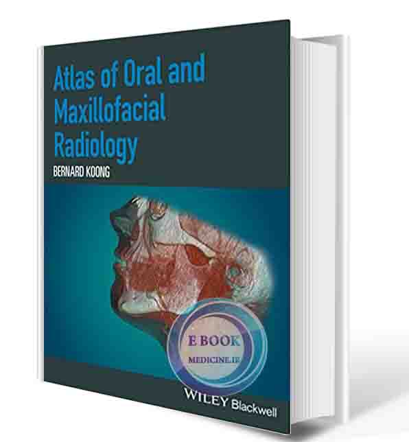 دانلود کتاب Atlas of Oral and Maxillofacial Radiology 1st  2017 (ORIGINAL PDF) 